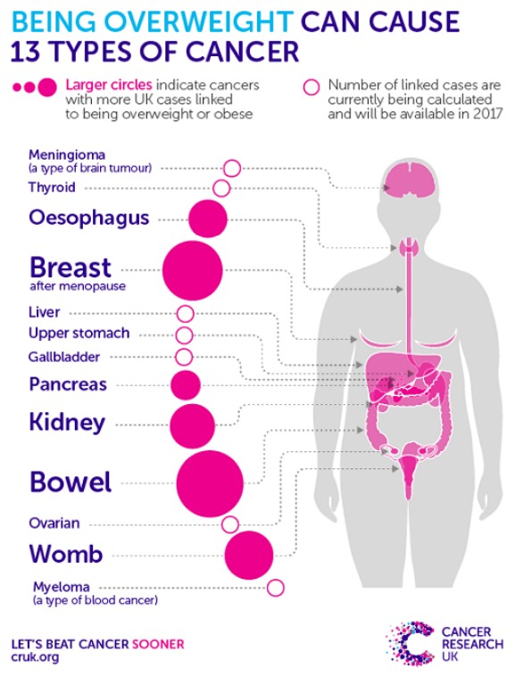 Being Overweight Can Cause 13 Types of Cancer